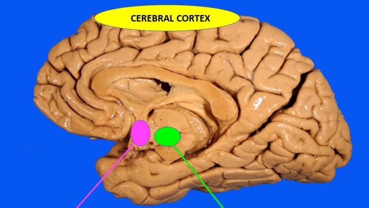 The cerebral cortex is shown at the top of the brain with the anterior hypothalamus and junction of forebrain and brainstem positioned below at the lower part of the brain.